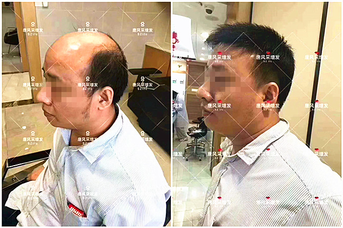 真人发隐形增发什么品牌好