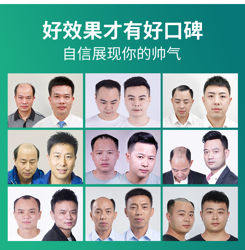 做隐形补发