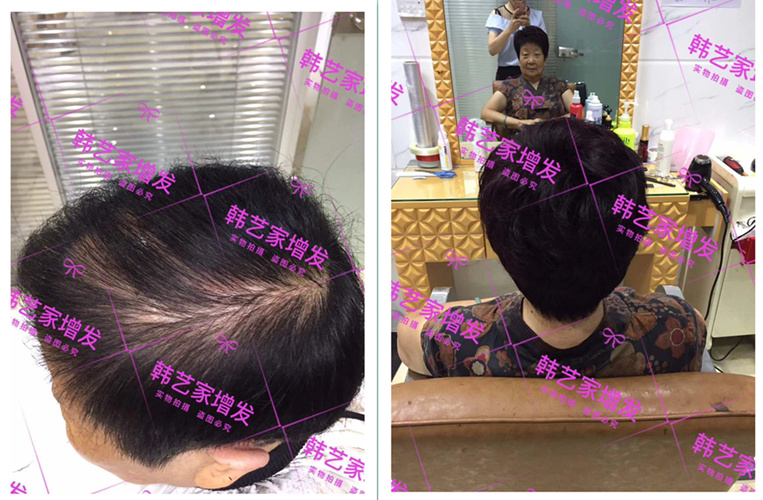 从今往后长长久久 客户案例