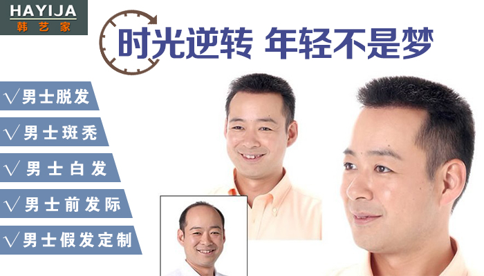 郑州织发补发机构哪家好？哪可以做隐形补发？