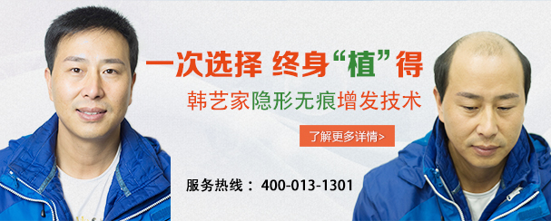 韩艺家在增发