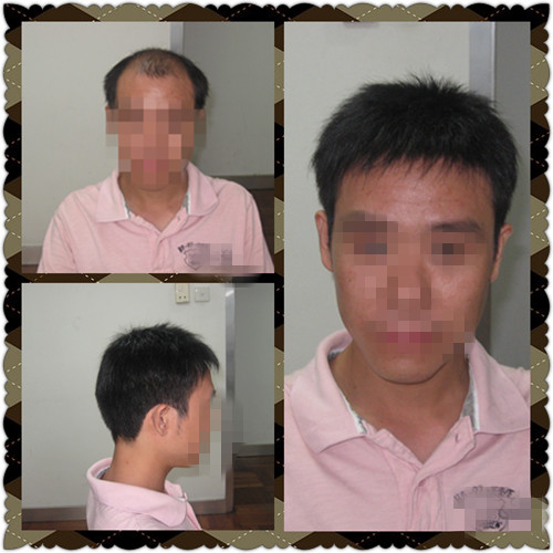 韩艺家增发让我重拾自信