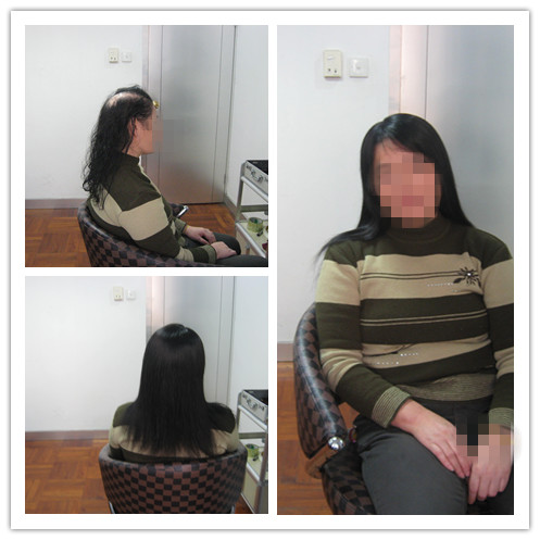 要买什么价位的织发补发比较合适