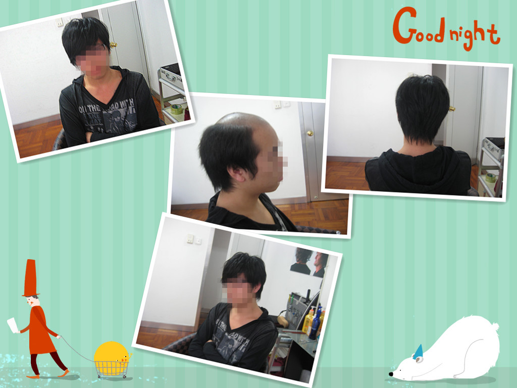 造成脱发的原因和注意事项