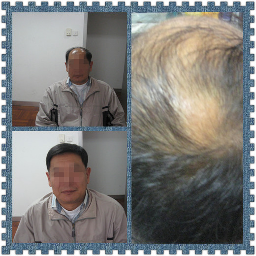 小编说；织发技术，让你拥有柔顺秀发